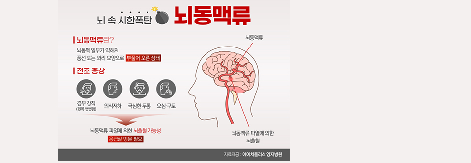 뇌